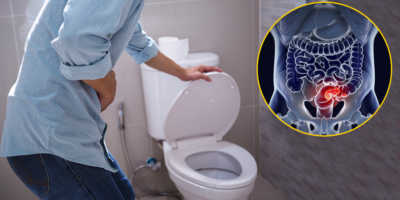 Diarrhea–Symptoms, Causes and Treatments