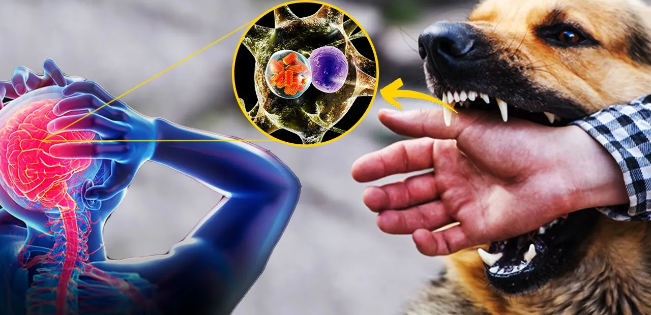 Rabies: Causes, Symptoms & Prevention